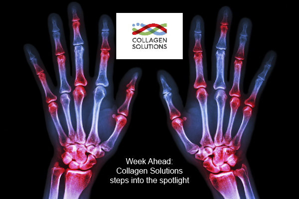 Week Ahead: Collagen Solutions steps into the spotlight